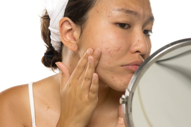 Fraxel®, RF Microneedling, Halo™, Chevy Chase & Washington DC