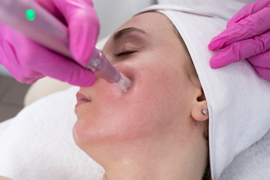 rf microneedling procedure